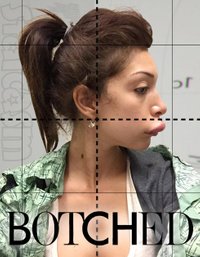 Botched - Season 1